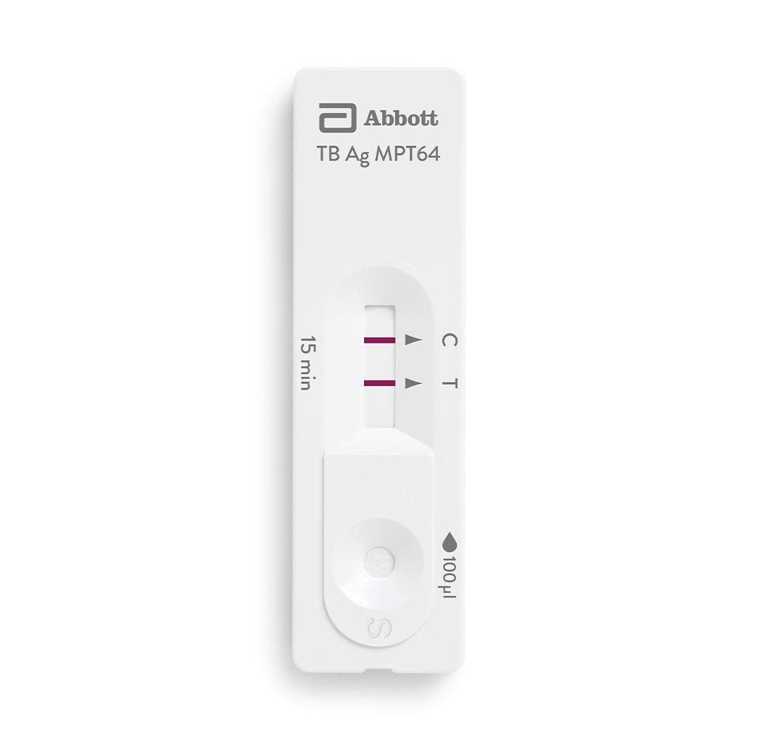 BIOLINE™ TB Ag MPT64